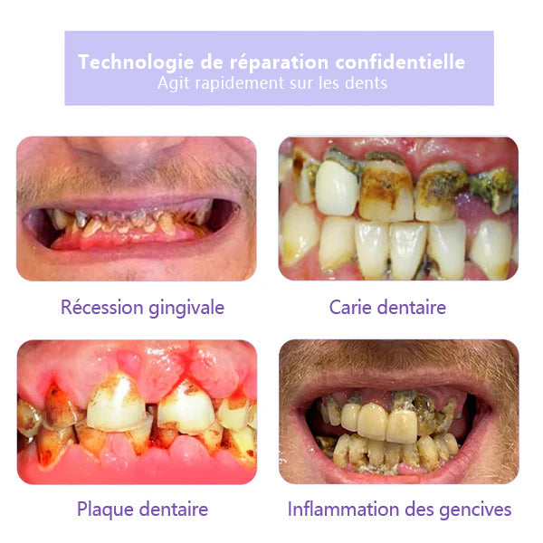 ODALIT™ 𝐓𝐞𝐞𝐭𝐡 𝐑𝐞𝐬𝐭𝐨𝐫𝐚𝐭𝐢𝐨𝐧 𝐏𝐨𝐮𝐝𝐫𝐞 𝐌𝐢𝐧é𝐫𝐚𝐥𝐞👨‍⚕️(𝐑𝐞𝐜𝐨𝐦𝐦𝐚𝐧𝐝é 𝐩𝐚𝐫 𝐀𝐬𝐬𝐨𝐜𝐢𝐚𝐭𝐢𝐨𝐧 𝐃𝐞𝐧𝐭𝐚𝐢𝐫𝐞 𝐅𝐫𝐚𝐧ç𝐚𝐢𝐬𝐞)