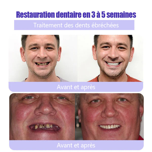 ODALIT™ 𝐓𝐞𝐞𝐭𝐡 𝐑𝐞𝐬𝐭𝐨𝐫𝐚𝐭𝐢𝐨𝐧 𝐏𝐨𝐮𝐝𝐫𝐞 𝐌𝐢𝐧é𝐫𝐚𝐥𝐞👨‍⚕️(𝐑𝐞𝐜𝐨𝐦𝐦𝐚𝐧𝐝é 𝐩𝐚𝐫 𝐀𝐬𝐬𝐨𝐜𝐢𝐚𝐭𝐢𝐨𝐧 𝐃𝐞𝐧𝐭𝐚𝐢𝐫𝐞 𝐅𝐫𝐚𝐧ç𝐚𝐢𝐬𝐞)