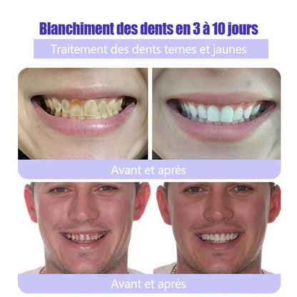 ODALIT™ 𝐓𝐞𝐞𝐭𝐡 𝐑𝐞𝐬𝐭𝐨𝐫𝐚𝐭𝐢𝐨𝐧 𝐏𝐨𝐮𝐝𝐫𝐞 𝐌𝐢𝐧é𝐫𝐚𝐥𝐞👨‍⚕️(𝐑𝐞𝐜𝐨𝐦𝐦𝐚𝐧𝐝é 𝐩𝐚𝐫 𝐀𝐬𝐬𝐨𝐜𝐢𝐚𝐭𝐢𝐨𝐧 𝐃𝐞𝐧𝐭𝐚𝐢𝐫𝐞 𝐅𝐫𝐚𝐧ç𝐚𝐢𝐬𝐞)